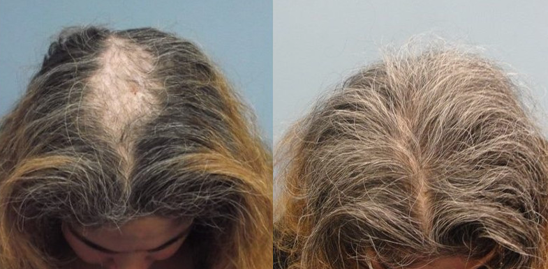 Before &After
